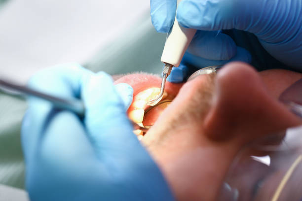 Best Emergency Broken Tooth Repair in Stuart, VA