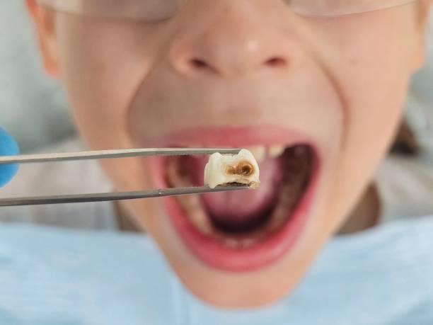 Best Emergency Orthodontic Repairs in Stuart, VA